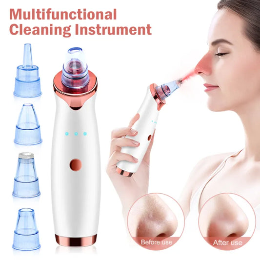 Vacuum Blackhead Remover Face Black Spots Cleaner White Dot Pimple Removal | Blackhead Remover for Nose,Facial Pore Acne Grease Cleaner Skin Care